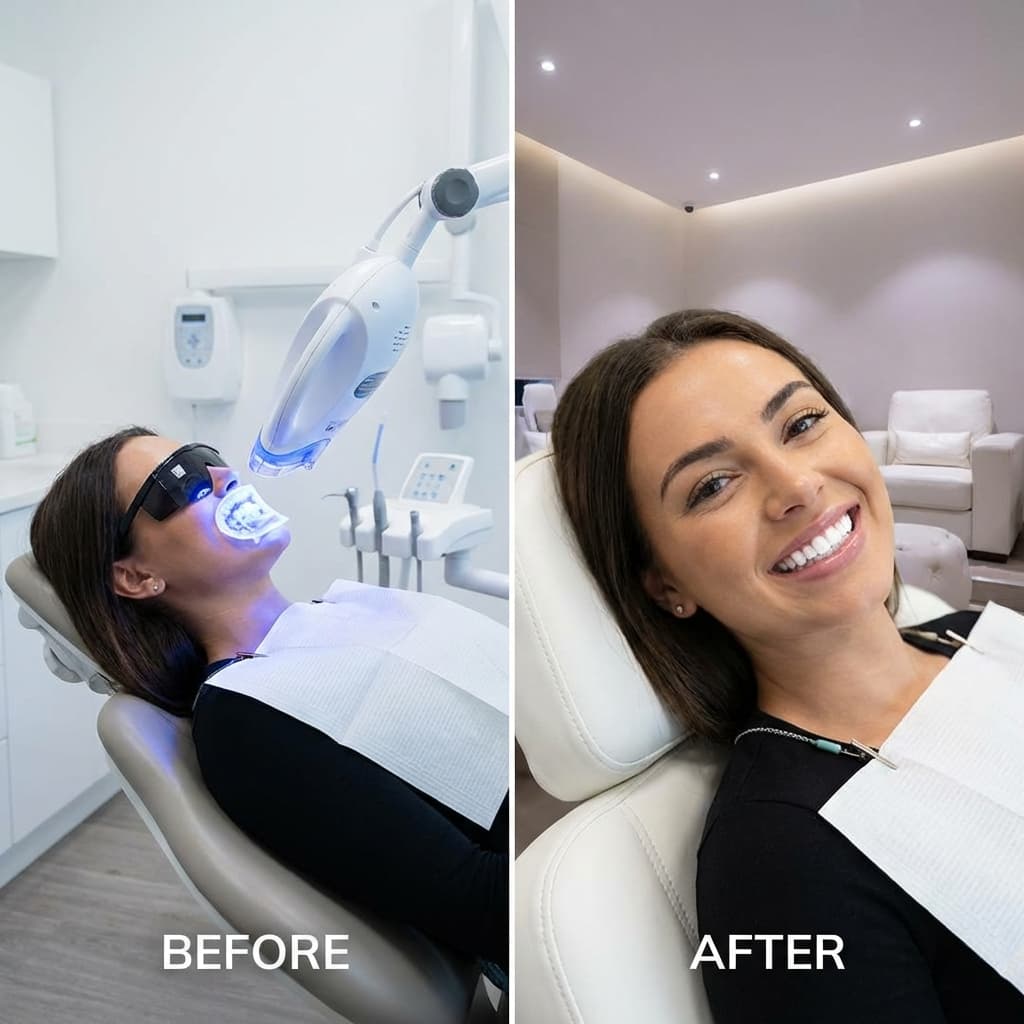 Teeth Whitening
